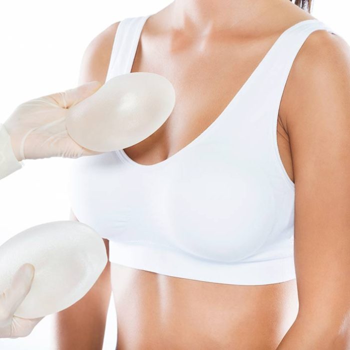 recambio-implantes-2